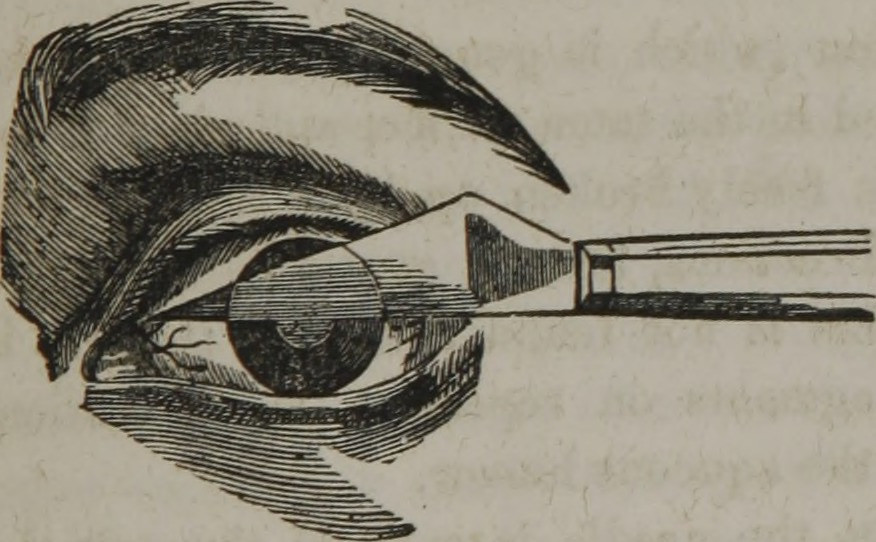 eye knife homeopathy illustration